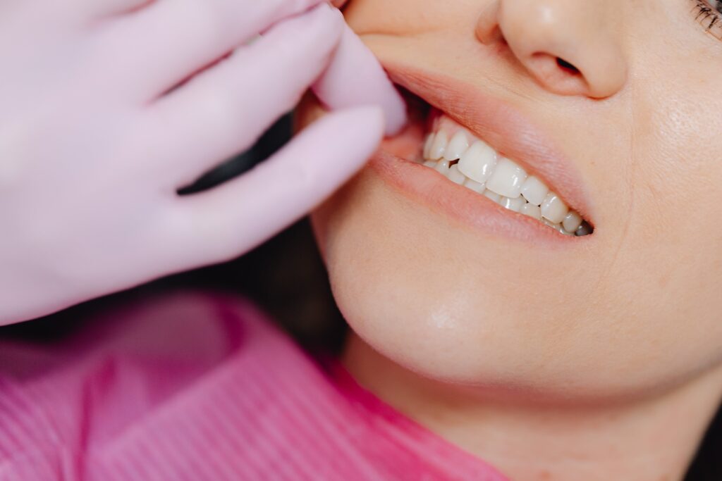 infiammazione gengive, sintomi cause trattamenti migliore clinica dentistica milano