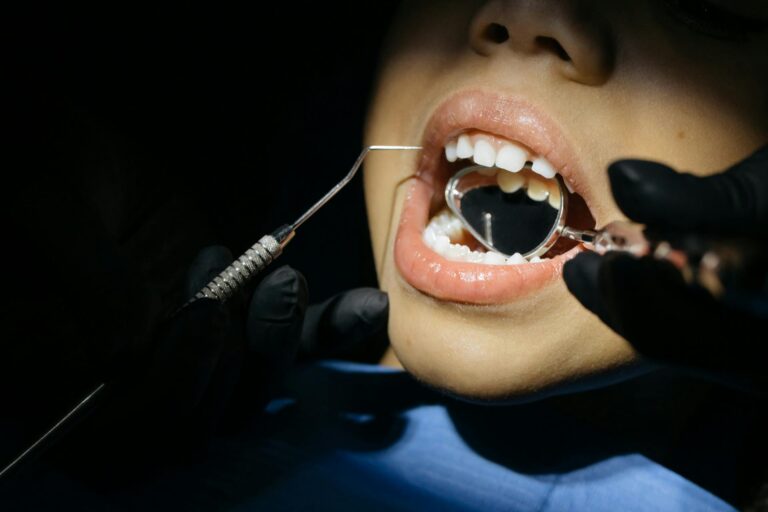 dentini cariati consigli per genitori per prevenire carie dei bambini